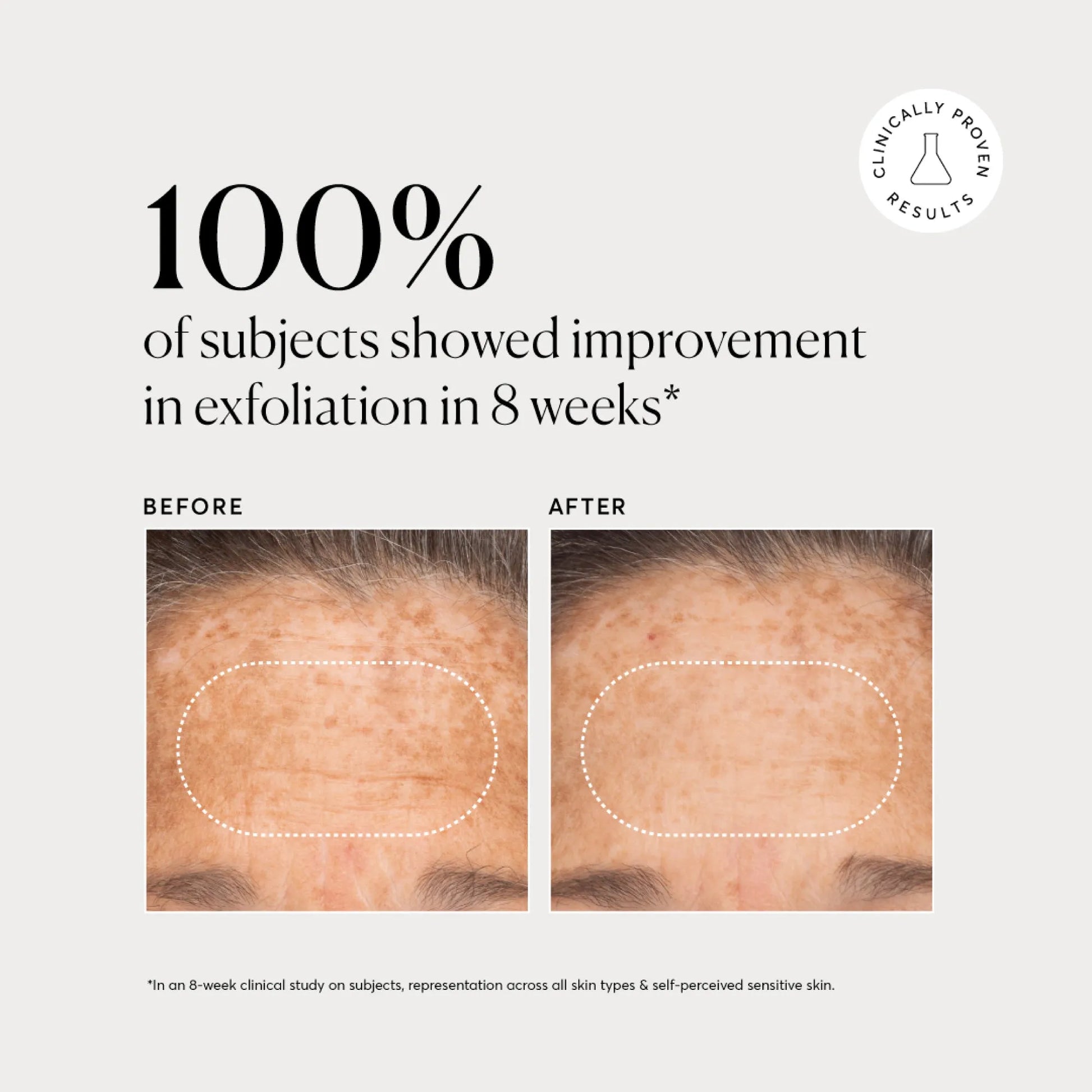 bha-liquid-exfoliant-2-k4 NATR-10027-Alt-Images-BHA-Liquid-Exfoliant-2_-03.webp